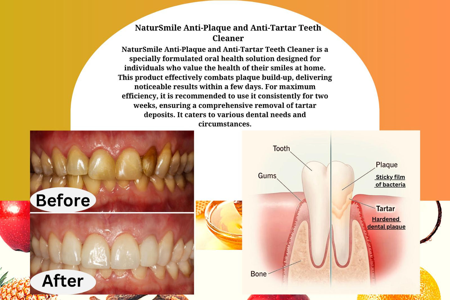 NaturSmile Anti-Plaque and Anti-Tartar Tooth Cleaner